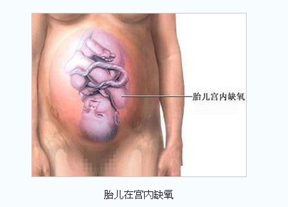 性剖腹产全过程  媽媽 + 寶寶