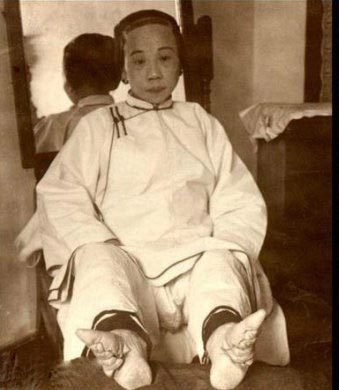 女性悲惨写真“三寸金莲”  歷史回顧
