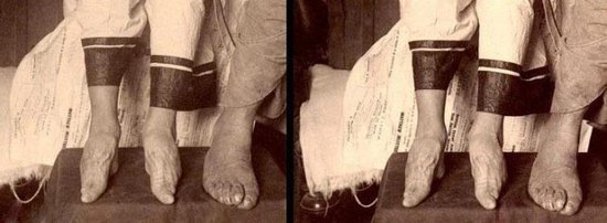 女性悲惨写真“三寸金莲”  歷史回顧