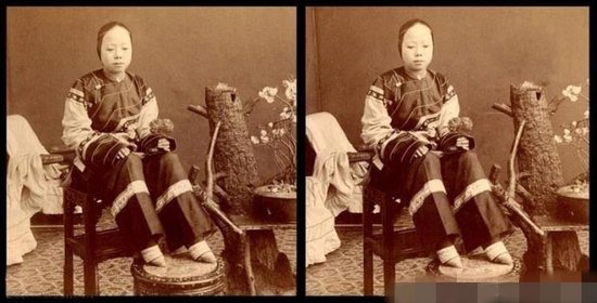 女性悲惨写真“三寸金莲”  歷史回顧