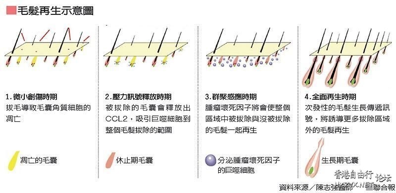 拔毛能治禿？  Hair Treatment髮室問症